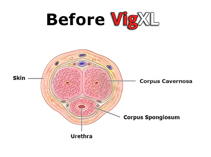 Before and Taking VigXL